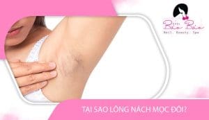 Tại sao lông nách mọc đôi