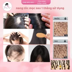 dầu gội bồ kết hoa sen