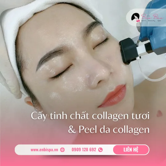 Cấy tinh chất collagen tươi và peel da collagen