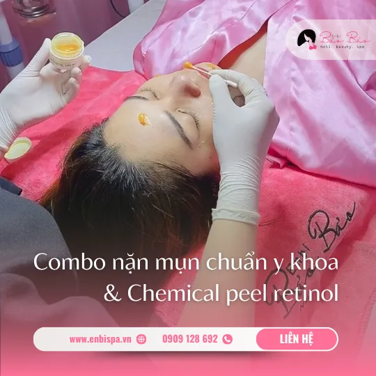 Combo nặn mụn chuẩn y khoa và chemical peel retinol