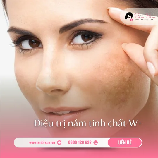 Điều trị nám tinh chất W+